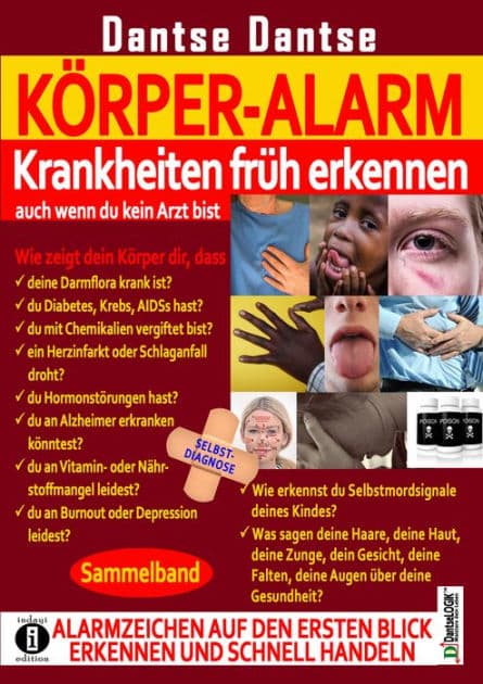 Körper-Alarm: Krankheiten früh erkennen, auch wenn du kein Arzt bist! - Sammelband: Alarmzeichen auf den ersten Blick erkennen und schnell handeln by Guy Dantse