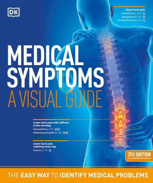 Medical Symptoms: A Visual Guide, 2nd Edition: The Easy Way to Identify Medical Problems by DK