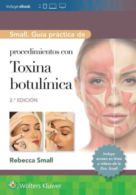 Small. Guía práctica de procedimientos con toxina botulínica by Rebecca Small MD
