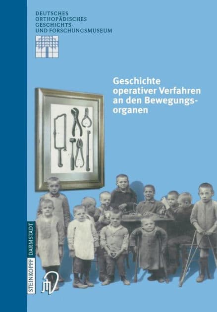 Geschichte operativer Verfahren an den Bewegungsorganen by L. Zichner