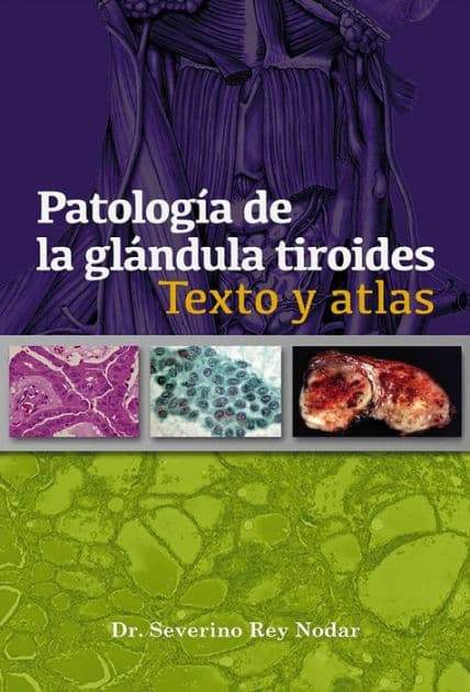 Patolog a de la gl ndula tiroides: Texto y atlas by Severino Rey