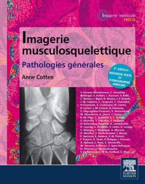 Imagerie musculosquelettique : pathologies générales by Anne Cotten