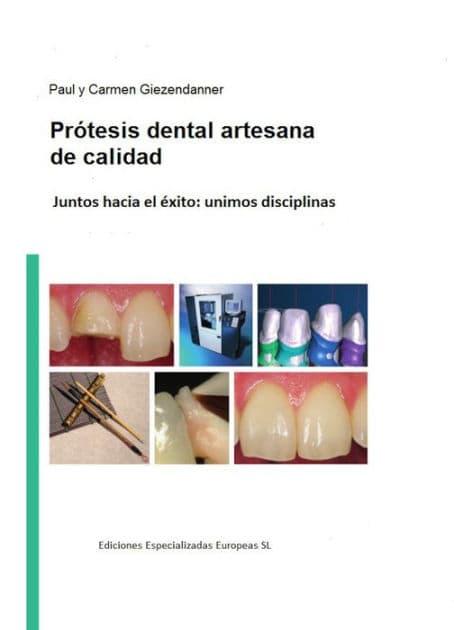 Prótesis dental artesanal de calidad: Juntos hacía el éxito: unimos disciplinas by Paul Giezendanner