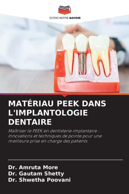 Matï¿½riau Peek Dans l'Implantologie Dentaire by Amruta More