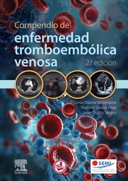 Compendio de enfermedad tromboembólica venosa by Sonia del Pilar Otálora Valderrama