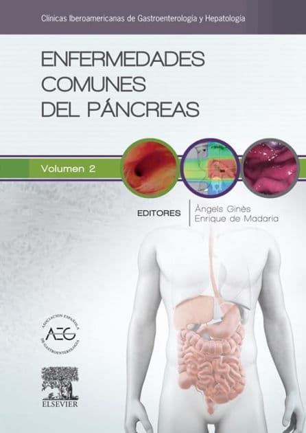 Enfermedades comunes del páncreas: Clínicas Iberoamericanas de Gastroenterología y Hepatología vol. 2 by Àngels Ginès Gibert