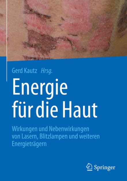 Energie fï¿½r die Haut: Wirkungen und Nebenwirkungen von Lasern, Blitzlampen und weiteren Energietrï¿½gern by Gerd Kautz