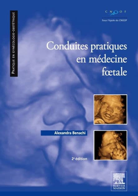 Conduites pratiques en médecine foetale by Alexandra Benachi