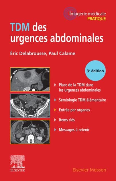 TDM des urgences abdominales by Eric Delabrousse