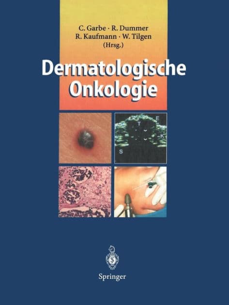 Dermatologische Onkologie by Claus Garbe
