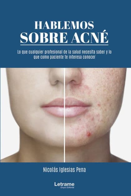 Hablemos sobre acné: 01 (Manual) by Nicolás Iglesias Pena