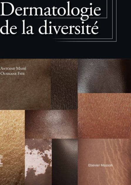Dermatologie de la diversité by Antoine Mahé