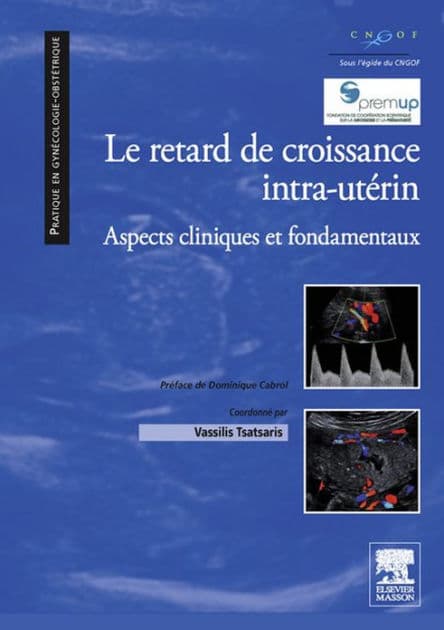 Le retard de croissance intra-utérin: Aspects cliniques et fondamentaux by Vassilis Tsatsaris