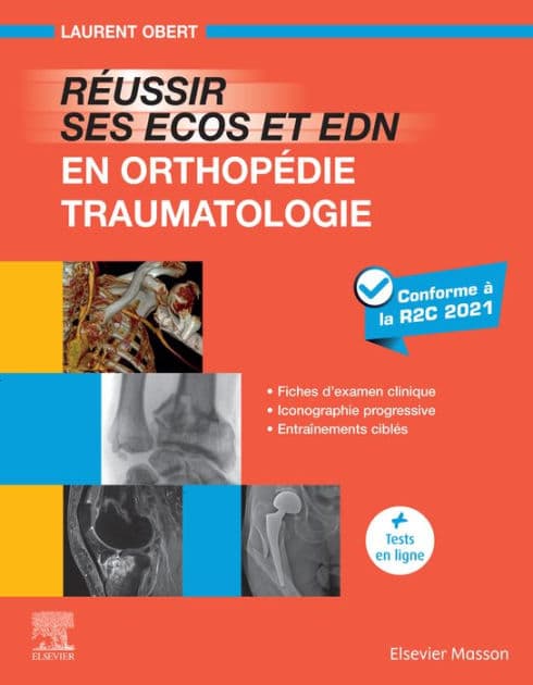 Réussir ses ECOS et EDN en Orthopédie - Traumatologie: Fiches d'examen clinique - Iconographie progressive - Entraînements ciblés by Laurent Obert