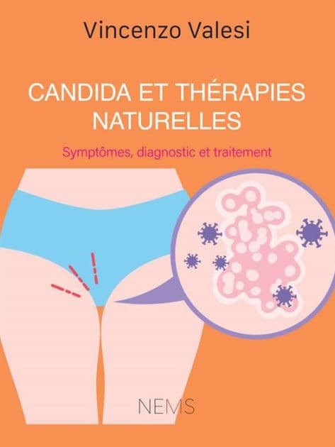 Candida et Thérapies naturelles: Symptômes, diagnostic et traitement by Vincenzo Ercole Valesi