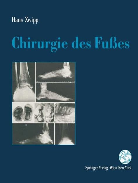 Chirurgie des Fuï¿½es by Hans Zwipp