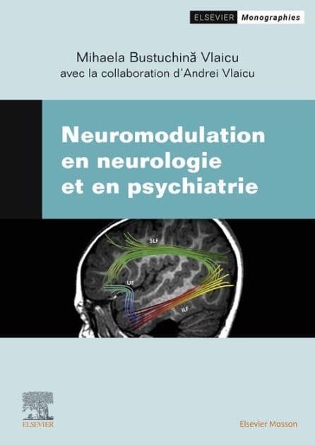 Neuromodulation en neurologie et en psychiatrie by Mihaela Bustuchina Vlaicu