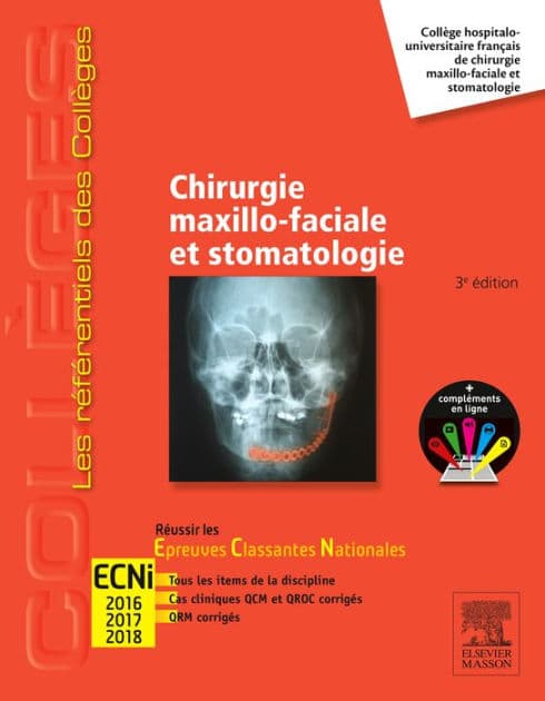 Chirurgie maxillo-faciale et stomatologie: Réussir les ECNi by Collège national des enseignants de chir