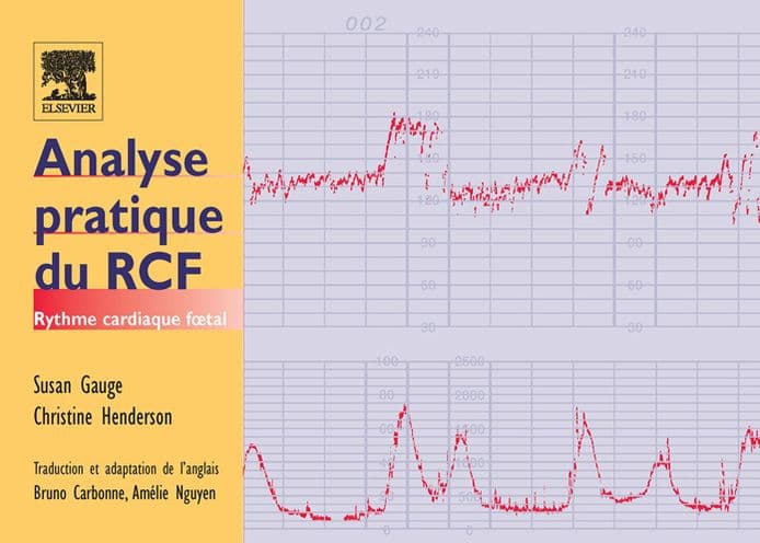 Analyse pratique du RCF: Rythme cardiaque fotal by SCM Gauge SRN