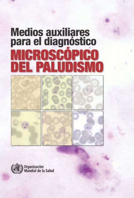Medios auxiliares para el diagnóstico microscópico del paludismo by World Health Organization