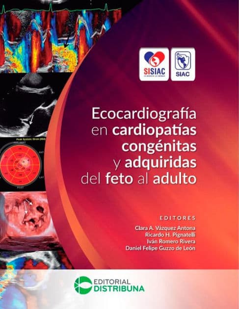 Ecocardiografía en Cardiopatías Congénitas y Adquiridas del Feto al Adulto by Clara Antona A. Vázquez