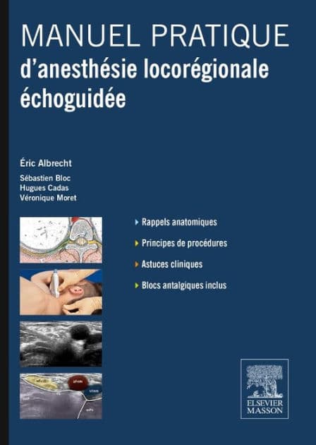 Manuel pratique d'anesthésie locorégionale échoguidée by Eric Albrecht