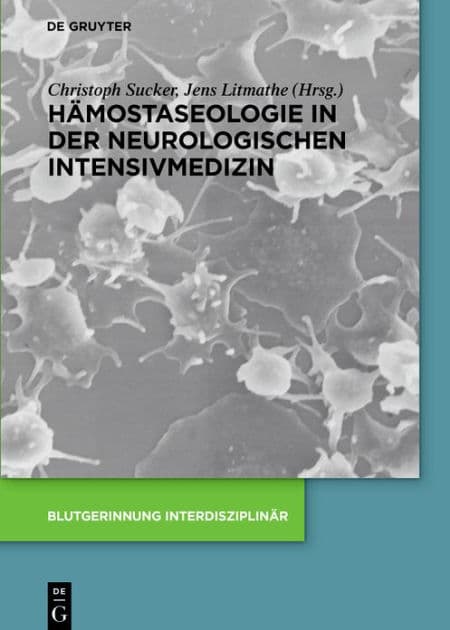 Hämostaseologie in der neurologischen Intensivmedizin by Christoph Sucker