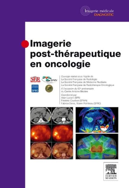 Imagerie post-thérapeutique en oncologie by Société Française de Radiologie