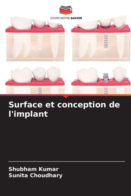 Surface et conception de l'implant by Shubham Kumar