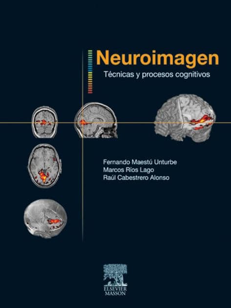 Neuroimagen. Técnicas y procesos cognitivos by Fernando Maestú Uturbe