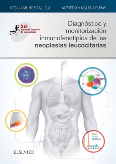 Diagnóstico y monitorización inmunofenotípica de las neoplasias leucocitarias: Sociedad Española de Inmunología by Cecilia Muñoz Calleja
