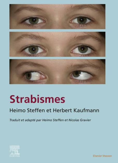Strabisme by Nicolas Gravier