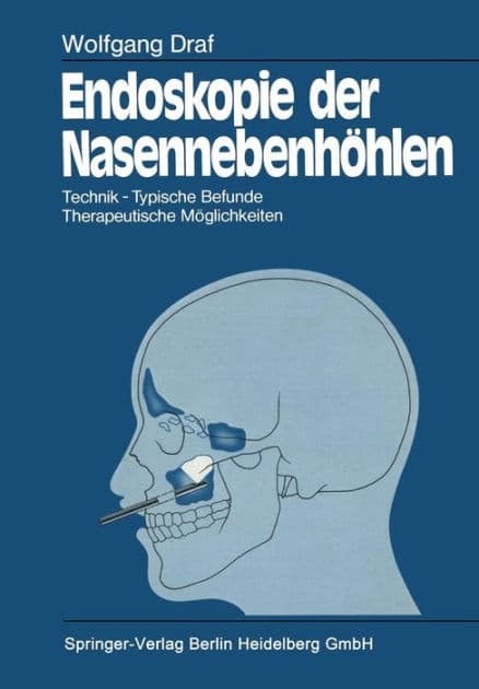 Endoskopie der Nasennebenhï¿½hlen: Technik ï¿½ Typische Befunde, Therapeutische Mï¿½glichkeiten by Wolfgang Draf
