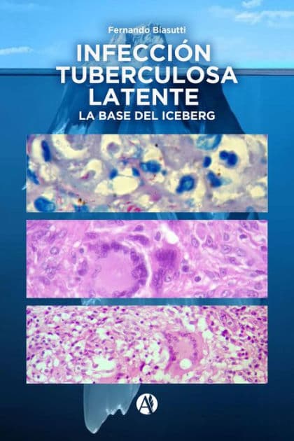 Infección Tuberculosa Latente, la base del iceberg by Fernando Biasutti