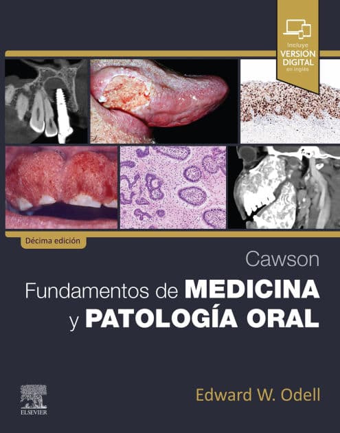 Cawson. Fundamentos de medicina y patología oral by MSc Odell FDSRCS