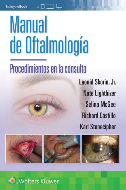 Manual de oftalmología. Procedimientos en la consulta by Leonid Skorin Jr.