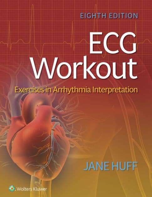 ECG Workout: Exercises in Arrhythmia Interpretation by LOREDA J. HUFF