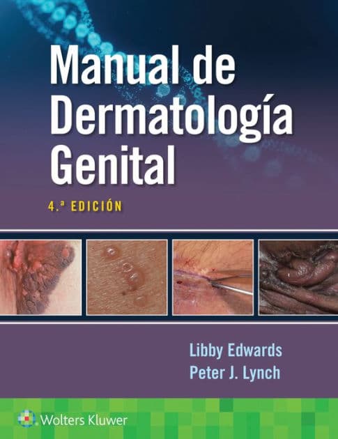 Manual de dermatología genital by Elizabeth Edwards