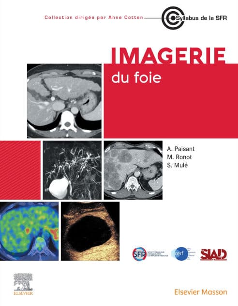 Imagerie du foie by Anita Paisant