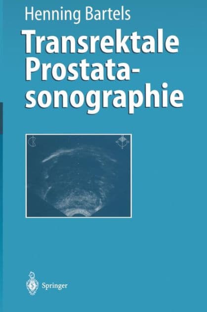 Transrektale Prostatasonographie by Henning Bartels