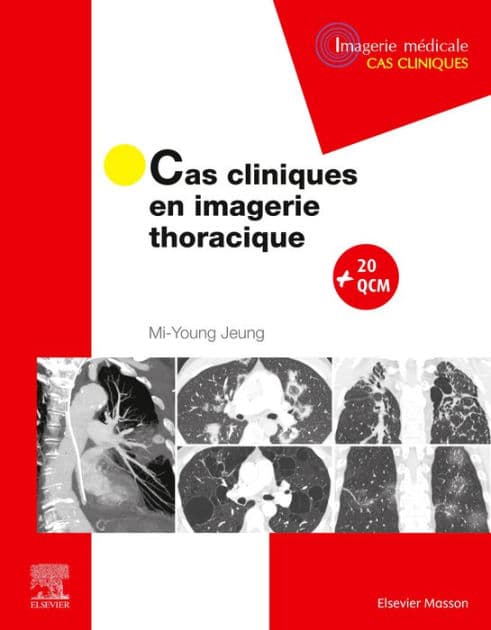 Cas cliniques en imagerie thoracique by Mi-Young Jeung