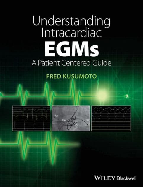 Understanding Intracardiac EGMs: A Patient Centered Guide by Fred M. Kusumoto