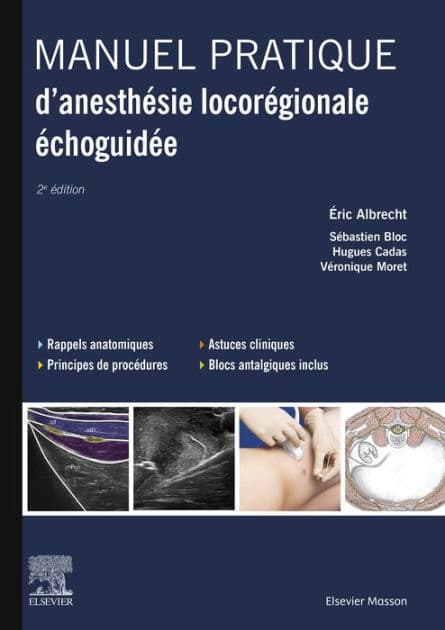 Manuel pratique d'anesthésie locorégionale échoguidée by Eric Albrecht