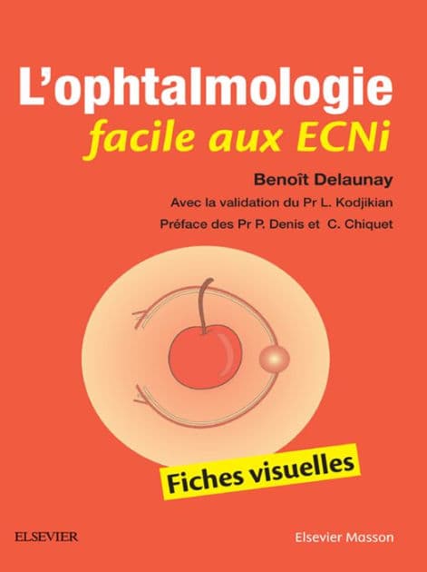 L'ophtalmologie facile aux ECNi: Fiches visuelles by Benoît Delaunay
