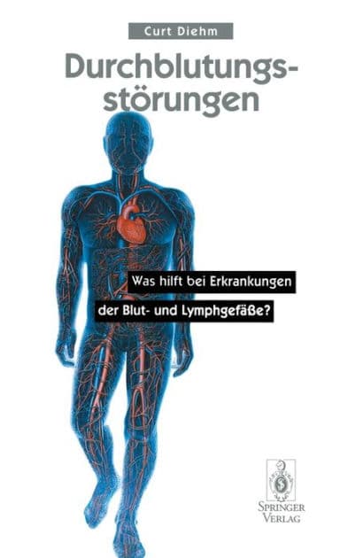 Durchblutungsstï¿½rungen: Was hilft bei Erkrankungen der Blutund Lymphgefï¿½ï¿½e? by Curt Diehm