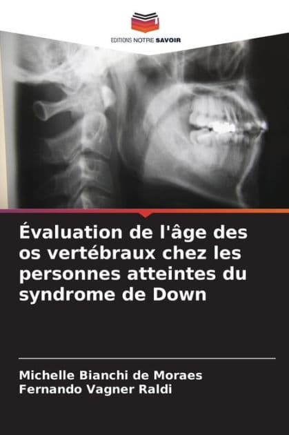 ï¿½valuation de l'ï¿½ge des os vertï¿½braux chez les personnes atteintes du syndrome de Down by Michelle Bianchi de Moraes