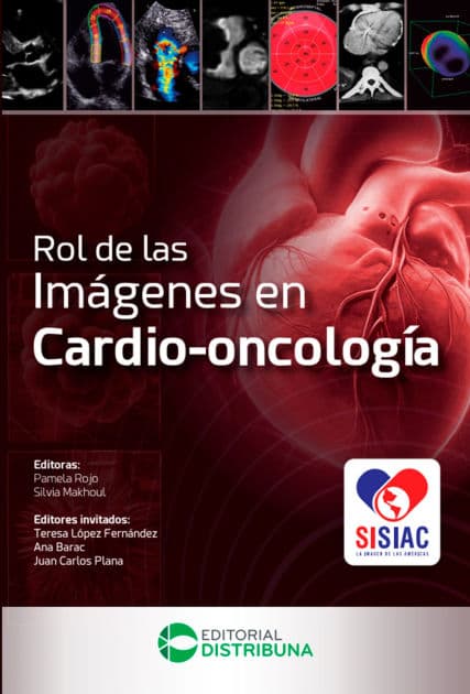 Rol de las imágenes en cardio-oncología by Pamela Rojo
