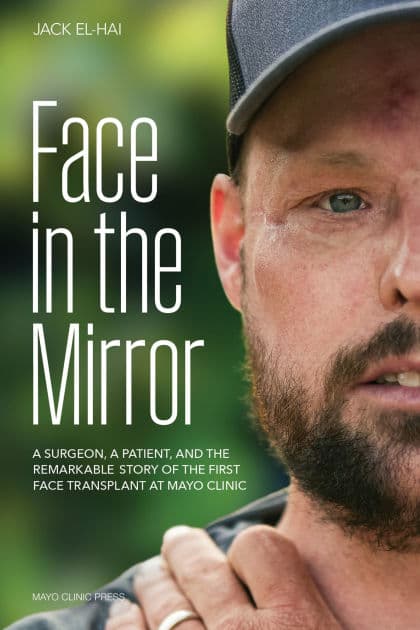 Face in the Mirror: A Surgeon, a Patient, and the Remarkable Story of the First Face Transplant at Mayo Clinic by Jack El-Hai