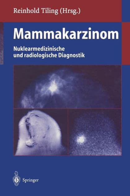 Mammakarzinom: Nuklearmedizinische und radiologische Diagnostik by Reinhold Tiling