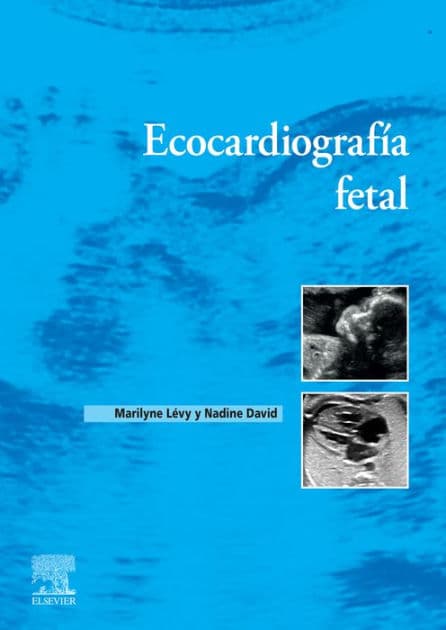 Ecocardiografía fetal by Maryline Lévy